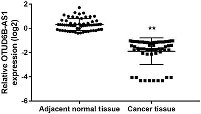 OTUD6B-AS1 Inhibits Viability, Migration, and Invasion of Thyroid Carcinoma by Targeting miR-183-5p and miR-21